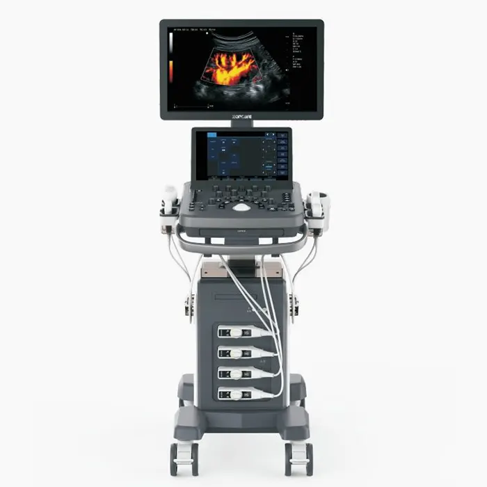 Ecógrafo N7 3D / 4D